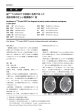 脳201Tl SPECTが診断に有用であった 造影効果の乏しい髄膜腫の1例