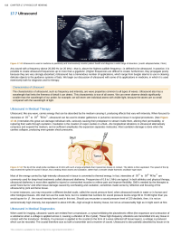 Ultrasound