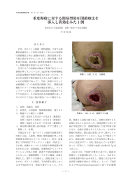 重度褥瘡に対する簡易型陰圧閉鎖療法を 導入し著効をみた 例