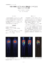 当院で経験した mTc-MAA 肺血流シンチによる 右左シャントの 例