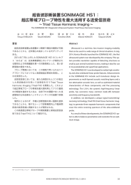 超音波診断装置SONIMAGE HS1： 超広帯域プローブ
