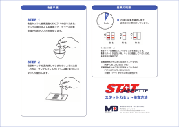 スタットカセット検査方法