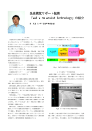 先進視覚サポート技術 「VAT:View Assist Technology」