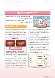 歯周病と関節リウマチ