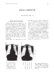 7. 結核症のX 線病型分類 高瀬 昭 607-617