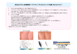 安定化ビタミンB6誘導体「パナドキシン&reg; P」のスキンケア効果（毛穴