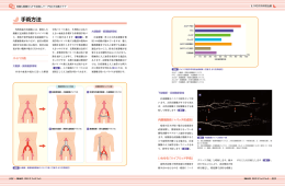 手術方法