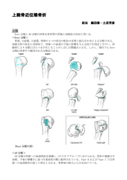 上腕骨近位端骨折