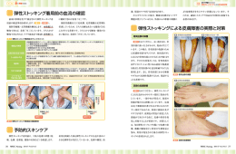 弾性ストッキング着用前の血流の確認 予防的スキンケア 弾性