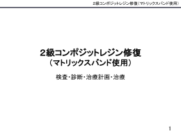 2級コンポジットレジン修復 （マトリックスバンド）